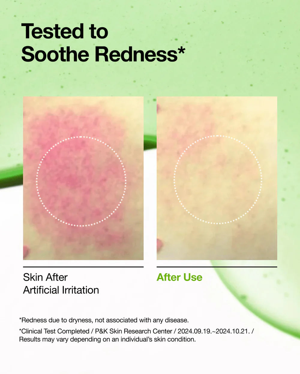 Redness Soothing Essential Set