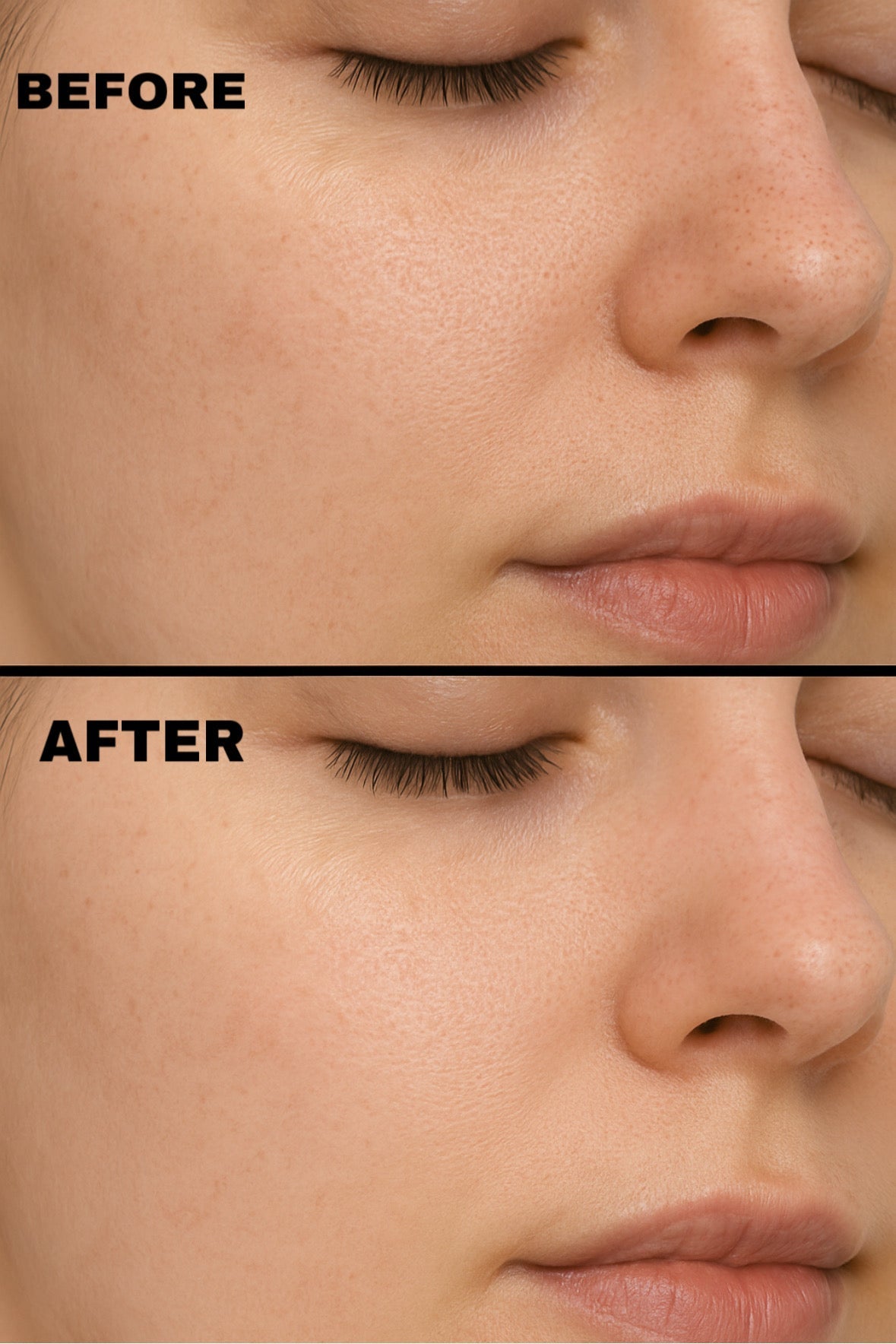 Pure Pore Extractor