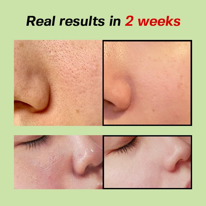Sungboon Editor Green Tomato Pore Lifting Ampoule