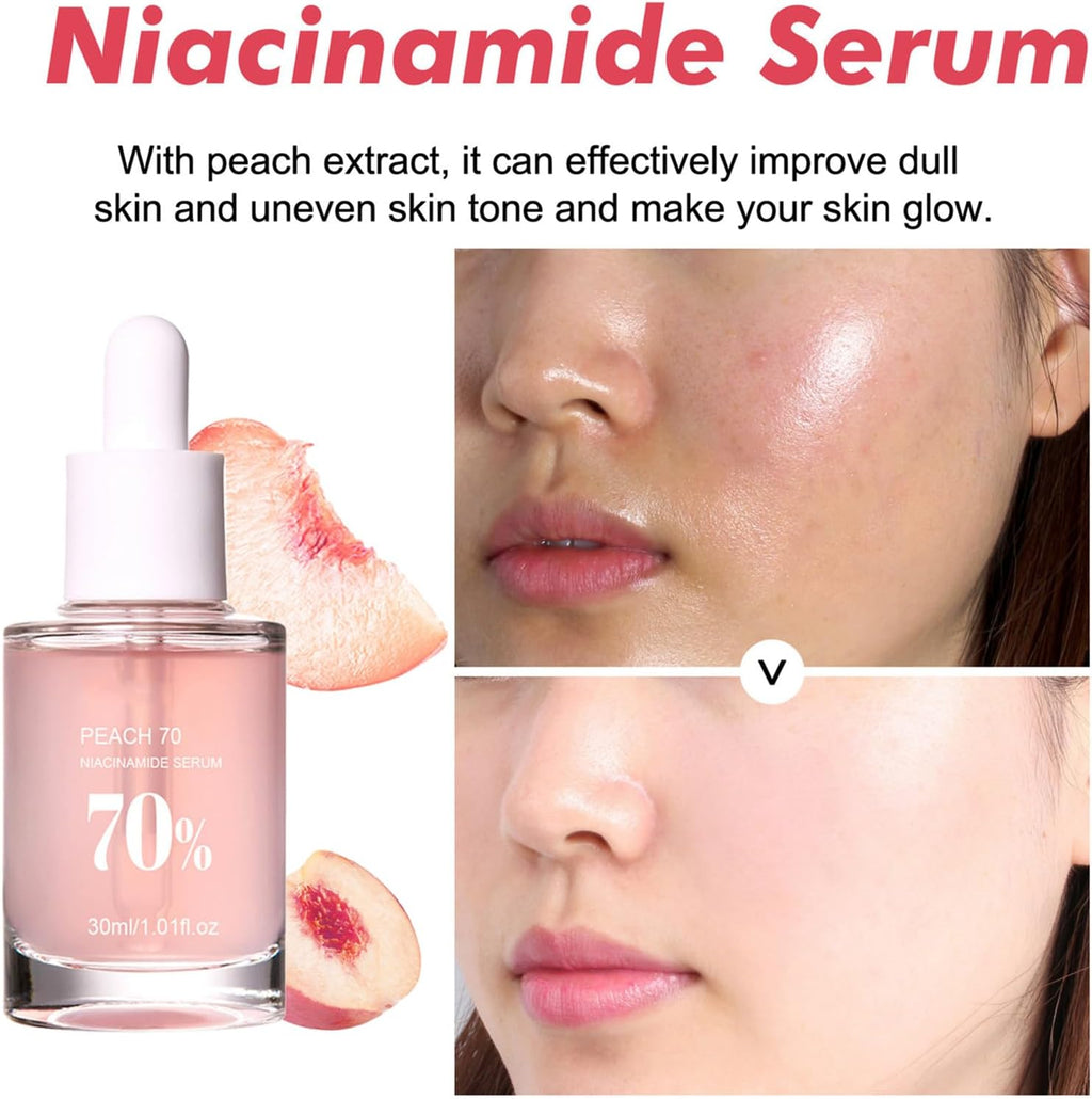 Anua Peach 70 Niacin Serum