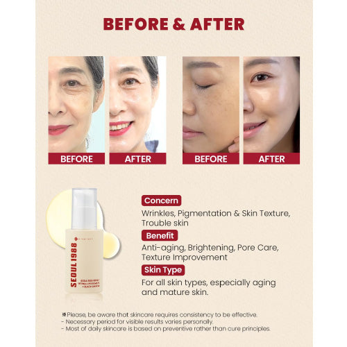[KSECRET] SEOUL 1988 Serum Retinal Liposome 2% + Black Ginseng 30ml